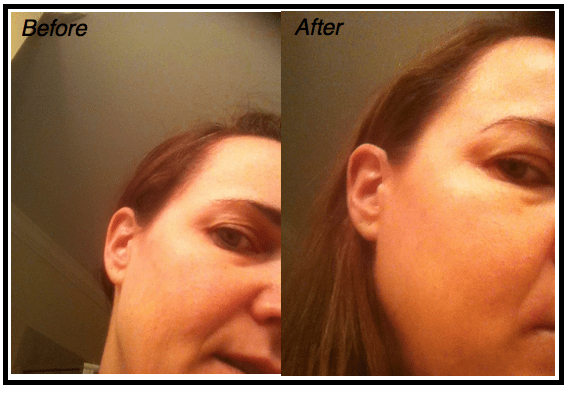 -Nerium-Testing-Before-After CelebrateWomanToday.com