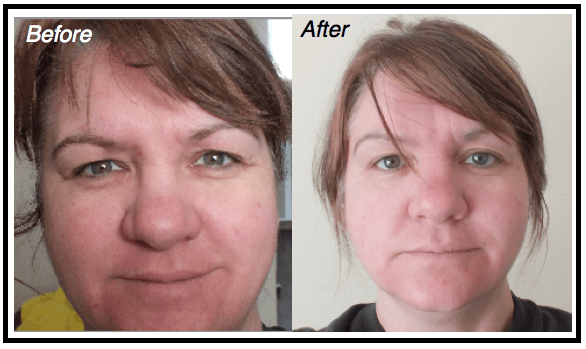 Nerium-Testing-Before-After CelebrateWomanToday.com